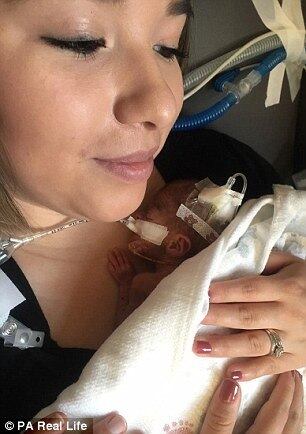 Marissa — que tem um filho mais velho, de 6 anos, com seu marido Robert — teve uma gravidez saudável, até o momento em que passou por exames de rotina na 20ª semana de gravidez, com o objetivo de verificar a possível ocorrência de síndrome de Down no menino