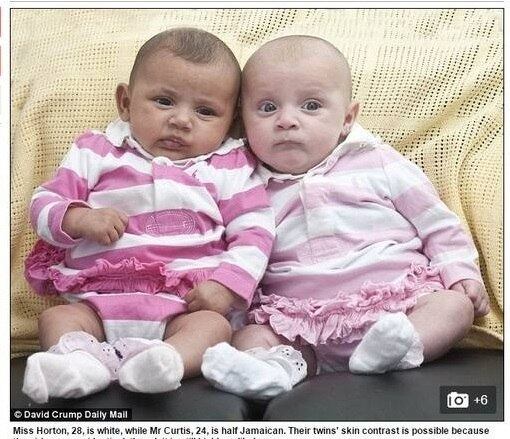 Já em abril de 2015, foi a vez das irmãs Kendall e Baylee chamarem
a atenção nas redes sociais. Na época, a mãe das meninas, Rebecca Horton, contou em entrevista ao
jornal britânico Daily Mail que, quando as meninas nasceram, ela e o marido ficaram
incrédulos, por uma ser branca e a outra negra. 



— Foi um sentimento maravilhoso, e também um
choque tremendo