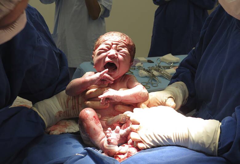 Bebê saudável, com o ritmo respiratório normal, deve ser colocado sobre o abdômen ou tórax da mãe