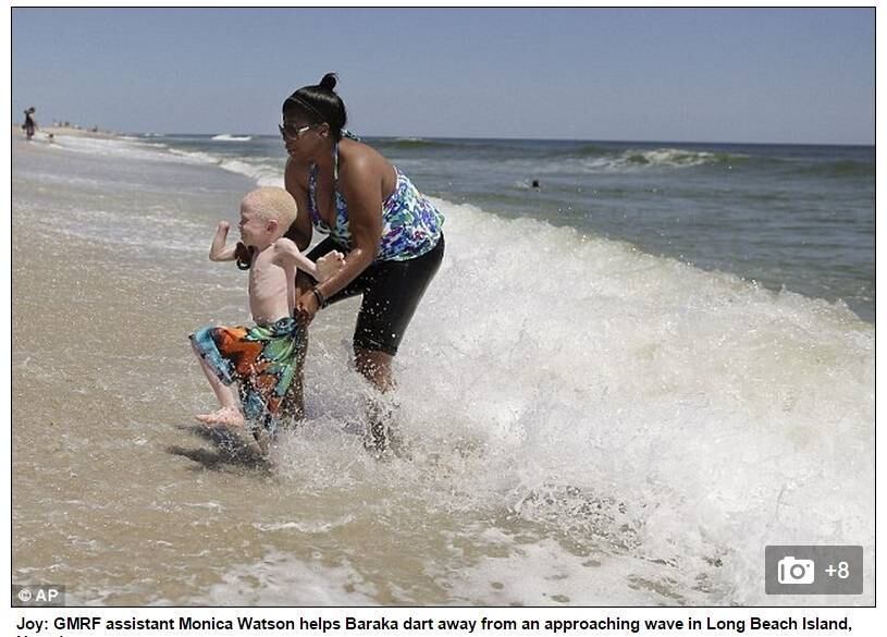 Baraka Cosmas Lusambo, de seis anos, também se lembra perfeitamente da noite em que homens armados com tochas e facas invadiram a casa da sua família na Tanzânia, bateram em sua mãe e deceparam sua mão direita