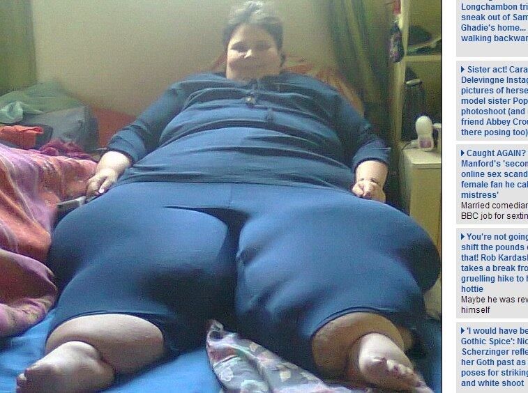 Sophia Loots, cujas pernas gigantescas fizeram com que vivesse como prisioneira em sua cama durante cinco anos, está pronta para andar novamente depois de conseguir drenar o excesso de líquido em suas pernas
