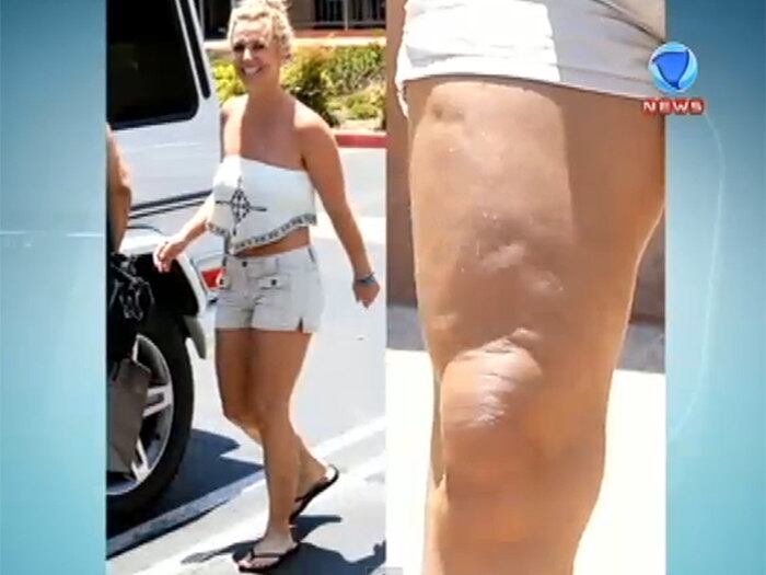 

A vítima da vez foi Britney Spears. A cantora virou notícia
por causa da celulite

