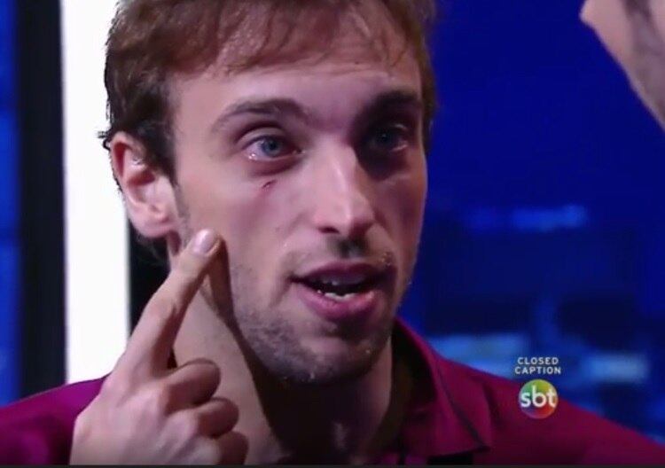 Na última terça-feira (14), uma brincadeira no início do programa The Noite acabou não dando certo. No início da atração, o apresentador Danilo Gentili "levou porradas" de dois amigos com aquelas boias tipo "espaguete". Em meio às cenas, o humorista Léo Lins se chocou com uma câmera e cortou o rosto 
