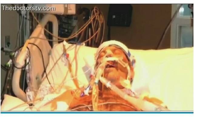 O homem passou quase um mês na UTI (Unidade de Terapia Intensiva), enquanto seu corpo lutava para combater a doença mortal. Gaylord
foi infectado em junho de 2013 quando tentou remover um rato da garganta de um
gato. Em 48 horas, ele começou a apresentar sintomas de gripe. Logo depois, sua
pele começou a ficar cinza e as glândulas embaixo dos braços incharam "quase
tão grandes como um limão"