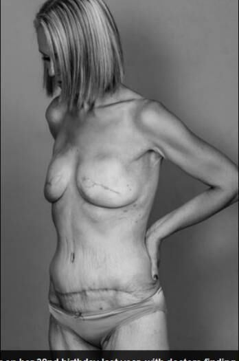 Beth explica que as críticas começaram logo após a postagem das fotos. Um homem
afirmou que não concordava com a atitude da australiana.
— Não
concordo que você poste fotos confrontadoras em um site em que as pessoas não têm
como escolher o que vão ver. Isso também pode aparecer para crianças