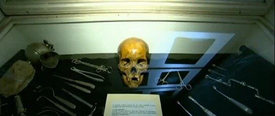 Hoje, o cenário de tanto horror ainda atende doentes mentais. Mas, segundo a diretora do hospital, a realidade do manicômio é bem diferente. Ao todo, 174 pacientes são tratados com dignidade, têm cama, refeitório e lazer. Toda a história de horror do maior hospício do Brasil pode ser relembrada no Museu da Loucura, que foi construído no prédio onde funcionava o manicômio

