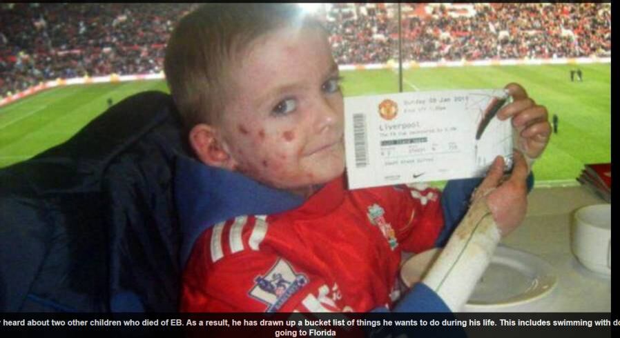 Segundo sua mãe, a agonia de Williams é tão grande que o jovem já teve
que tomar morfina para controlar a dor.
— Saber que eu não posso abraçá-lo melhor sem rasgar sua pele é de partir o coração