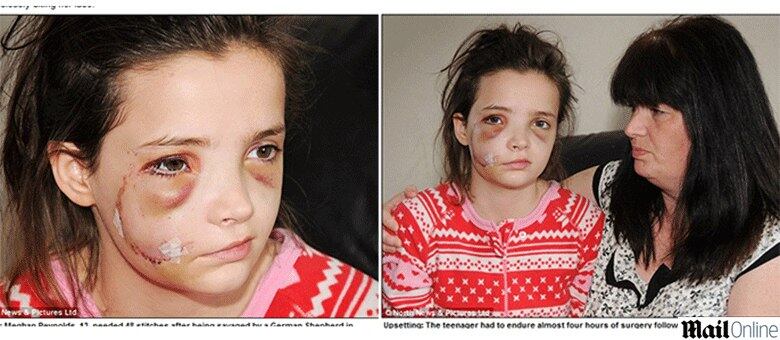 Meghan Reynolds levou 48 pontos no rosto e passou por cirurgia após o ataque do pastor-alemão