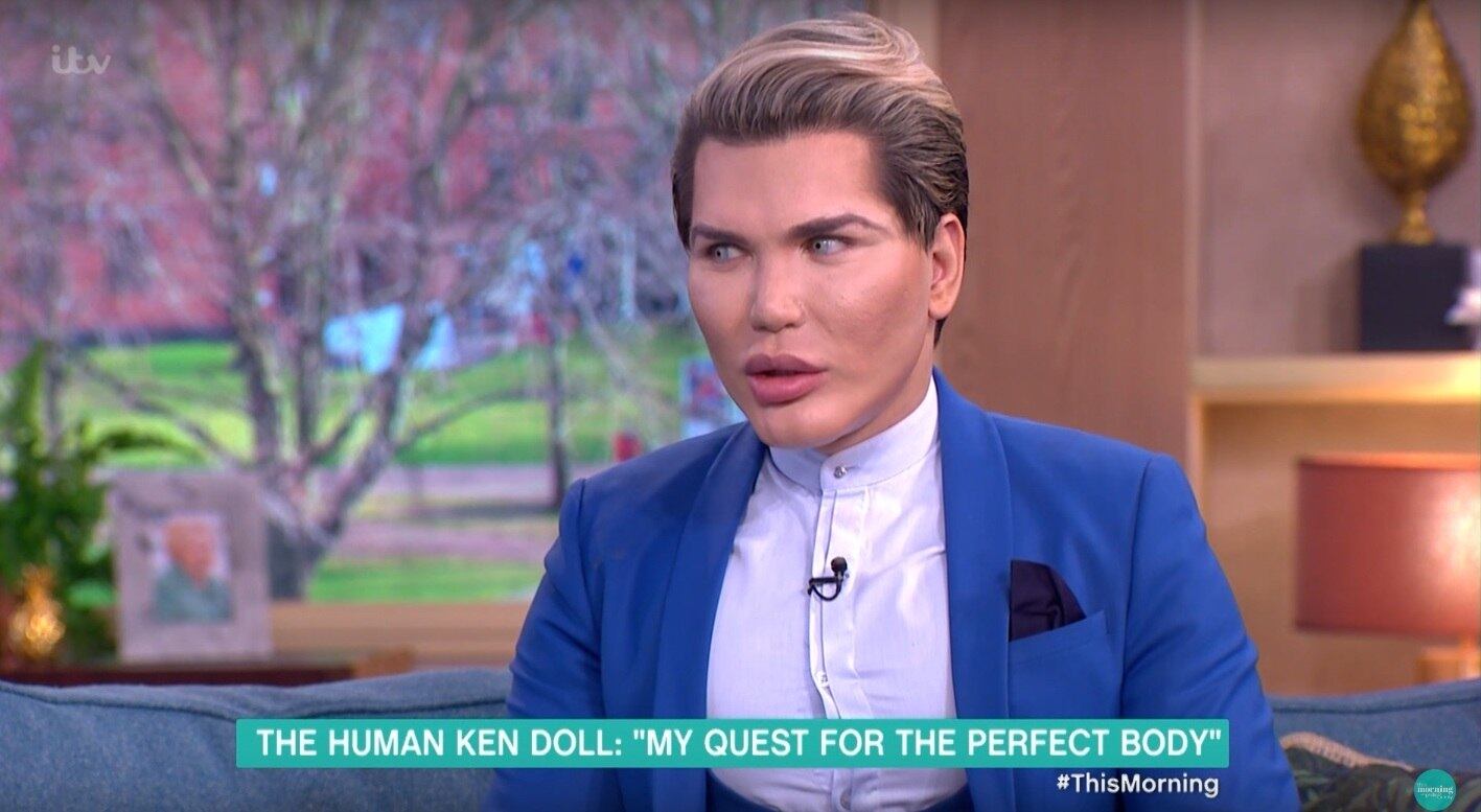 Rodrigo Alves deu entrevista a um programa britânico para falar de suas cirurgias plásticas
