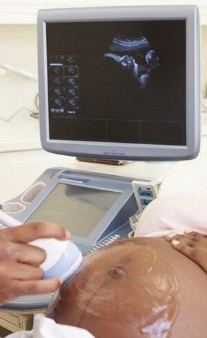 Medo do zica muda rotina de gestante