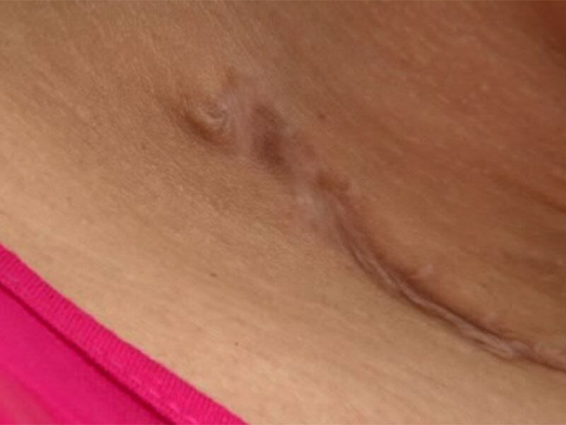 Após 15 dias em coma e cinco meses internada em uma unidade hospitalar na capital baiana, Nayara teve alta médica no dia do seu aniversário e deixou um recado para os jovens.

— Obedeça as suas mães, escute as suas mães. Eu sei que mãe sempre briga, tem aqueles momentos que a gente quer bater de frente, que ela está errada, que é chata, mas elas realmete sabem o que está acontecendo. E também não conhecer pessoas em redes sociais, não criar vínculos de amizades em redes sociais

