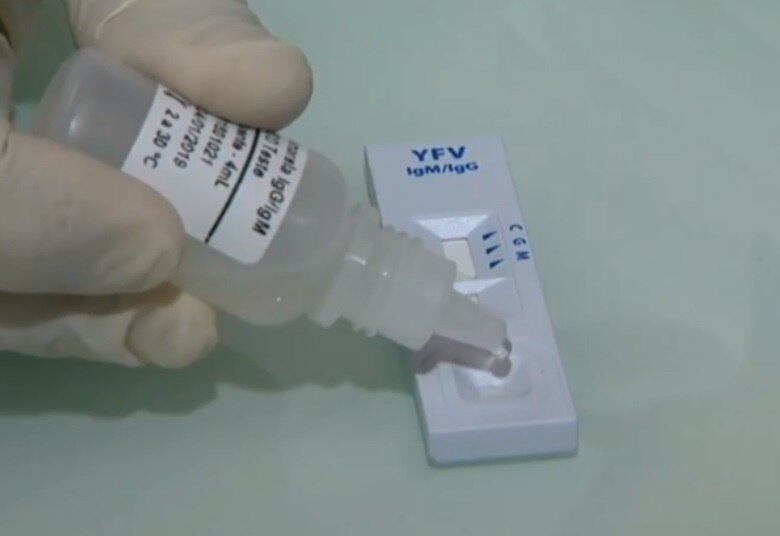Para fazer o exame, baste colocar na amostra uma gota de sangue e o reagente. Após 15 minutos, é possível descobrir se é um caso de febre amarela