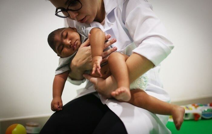 zika vírus, microcefalia, Angola