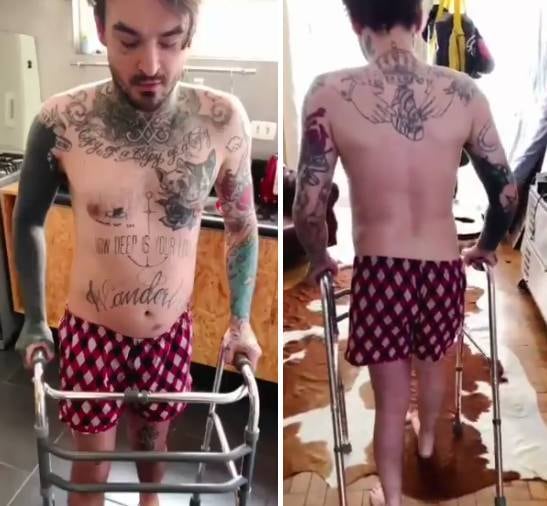 O youtuber PC Siqueira publicou fotos durante a recuperação da cirurgia