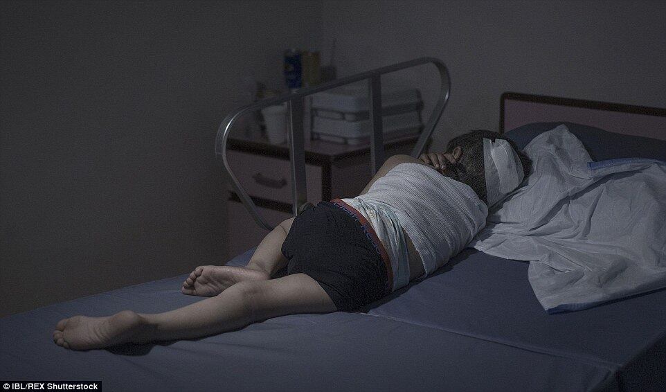 Moyad vive no campo de
refúgio de Aman, na Jordânia. Com 5 anos, ele recebe tratamento após ser ferido
com estilhaços na cabeça, costas e pélvis, de uma explosão que matou sua mãe