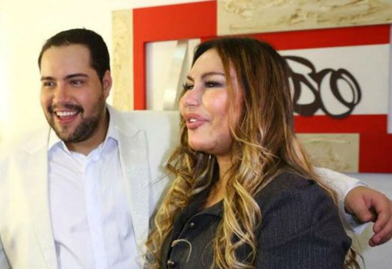 Procedimento estético muito popular entre as famosas, o preenchimento labial deve ser usado com moderação. Em caso de exageros, o resultado é uma aparência estranha e artificial, como prova essa foto de Rosanah. A cantora, famosa pelo refrão Como uma Deusa, está longe de ser um caso isolado...

• Assista aos programas jornalísticos da Record no r7.com/play
