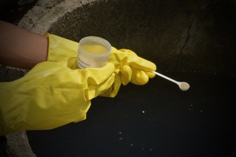 Em 2015, foram registrados 69.516 casos suspeitos no Rio