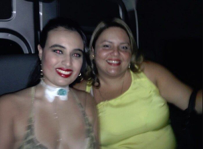 Em conversa com o R7, a mãe conta
que, por causa da doença, todos eles não sentem dores periféricas, ou seja, nas
mãos, pés e na parte superficial do corpo em geral. Apesar disso, o tipo de HSAN
que a dona de casa tem não prejudica tanto suas atividades diárias.

   
— Faço a maioria dos exames sem
anestesia. Todos brincam que isso é bom, mas queria eu que fosse alguma coisa
realmente positiva. Preferia sentir todas as dores do mundo do que ver a minha
filha nesse estado. Ela não sente as dores periféricas, mas chora por causa das
dores internas