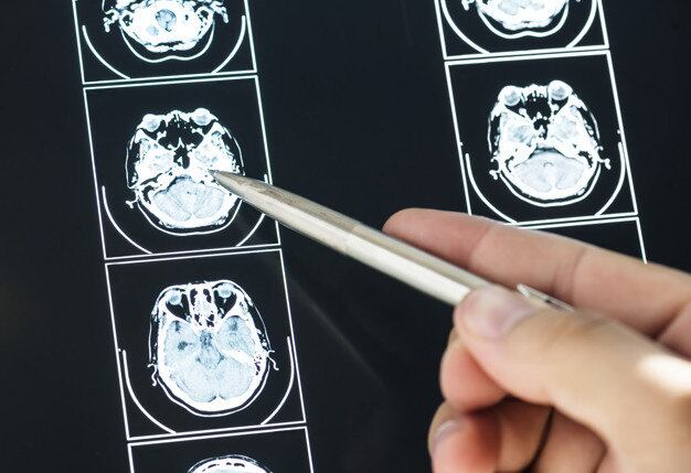 Proteína presente no vírus causador da Covid pode comprometer a memória