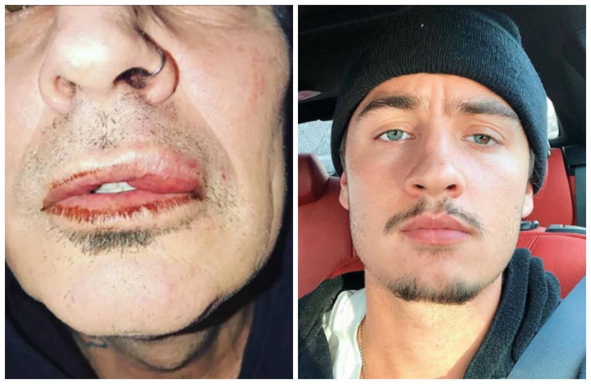 Tommy Lee diz ter sido agredido pelo seu filho
