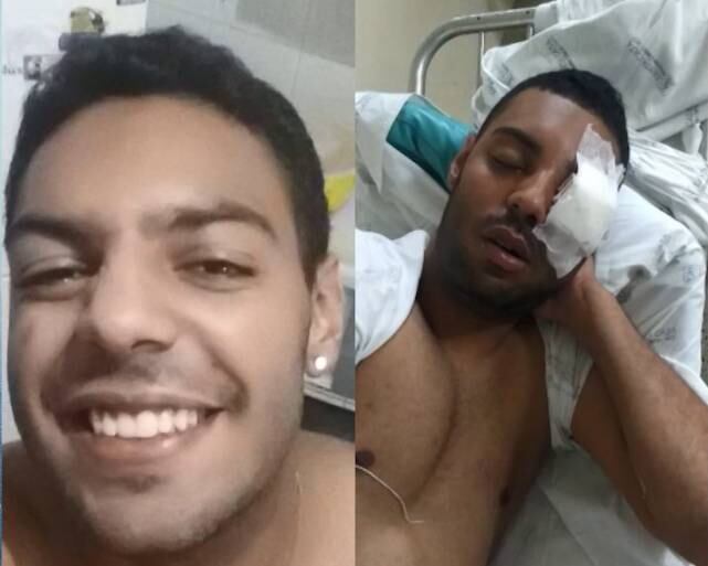 Jovem perdeu o olho esquerdo e teve que trancar o curso