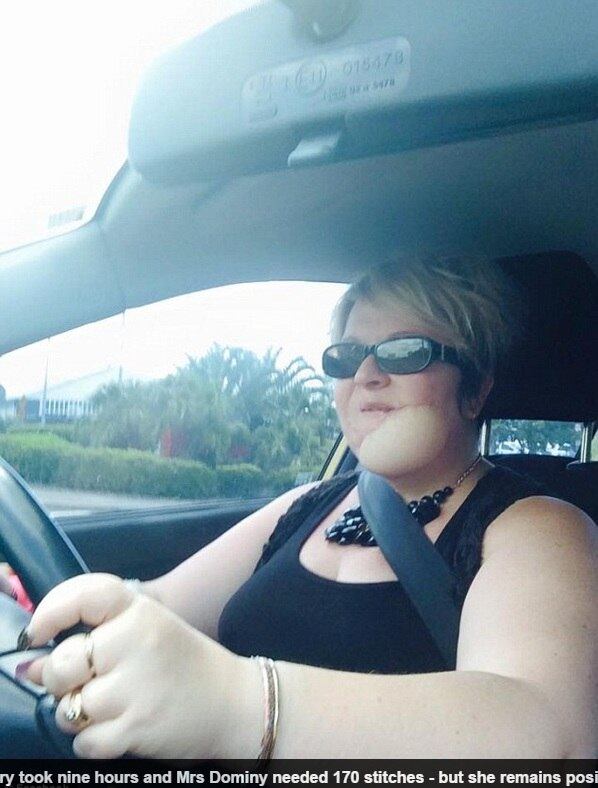 — O
médico me disse que se eu não tratasse rapidamente, o câncer se alastraria em
todo o meu rosto