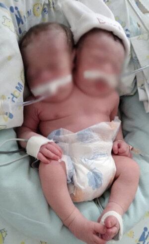 Caso é considerado raríssimo