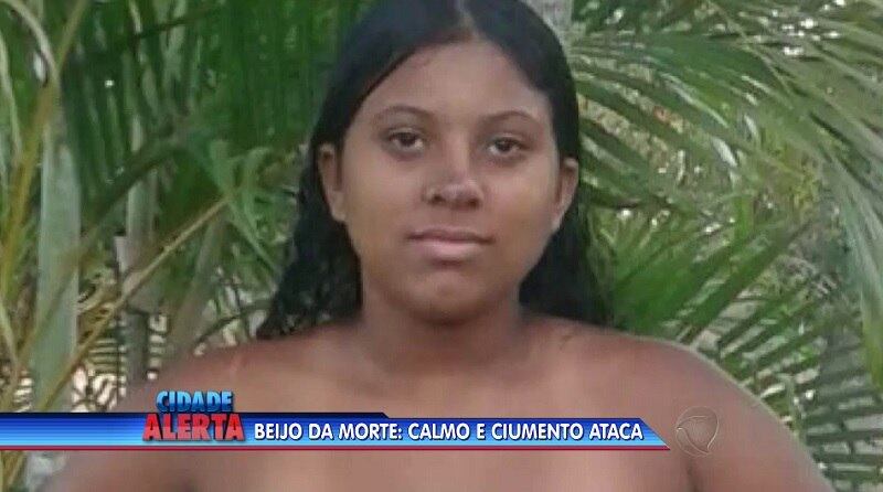 Durante o tempo em que ficaram juntos, o casal se separou uma vez. E as marcas do término ficaram no rosto da menor. Na foto, ela aparece com um machucado no nariz. O ferimento foi causado pelo rapaz, que não aceitava a separação