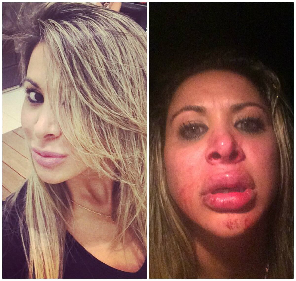 A candidata a Miss Bumbum pelo Distrito Federal em 2013 afirmou ter sido agredida por um homem na madrugada do último dia 30, em Cuiabá, Mato Grosso. A modelo, que participa do quadro Teste de Fidelidade no Programa do João Kleber, na Rede TV!, estava em uma casa noturna com as amigas, quando uma confusão foi iniciada