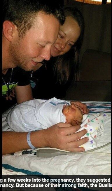 A mãe
descobriu que o menino tinha microhidranencefalia, uma má-formação cerebral
rara, ainda durante a gestação