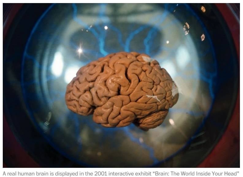 As conclusões foram que o uso extensivo da internet causa o encolhimentos de diversas pequenas regiões do cérebro. Quanto mais antigo o vício, maior a redução