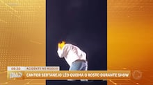Cantor Léo fica ferido após ter rosto atingido por fogo durante show no interior paulista