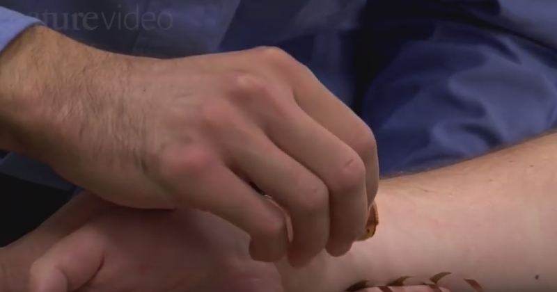 O estudo é um avanço, e não uma espécie de cura definitiva, uma vez que só funciona de verdade quando conectado a um computador