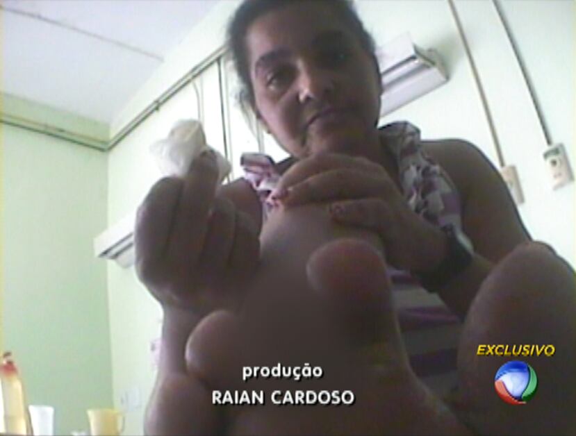 Elizabeth chegou ao hospital com o dedo ferido e pode perder a perna