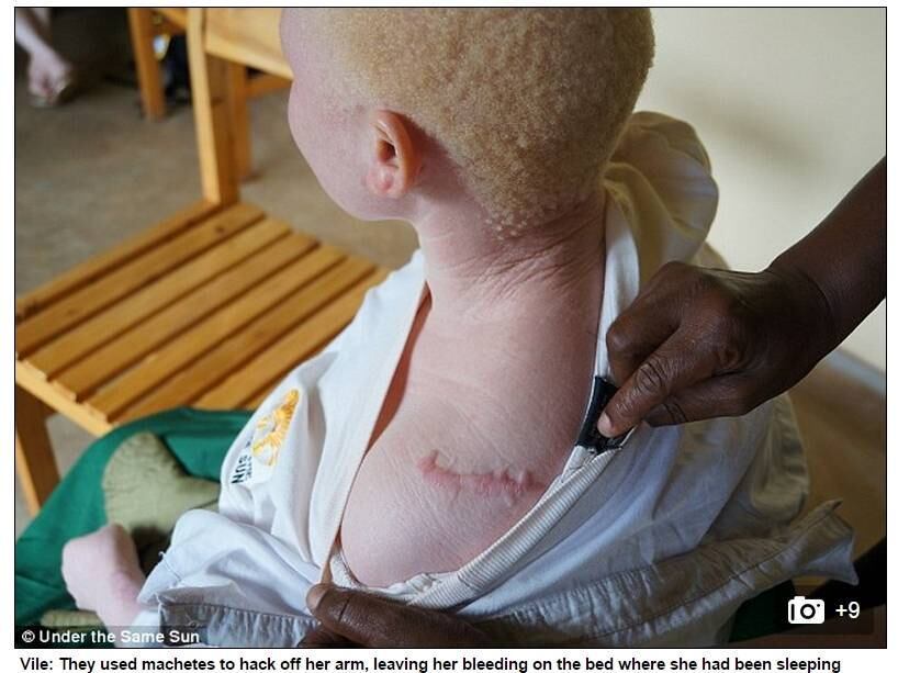 Os ladrões seguraram Lusana e a atacaram com machados, mutilando
seu braço e o enrolando em um casaco. Em seguida, eles fugiram, deixando a
garota para morrer sangrando