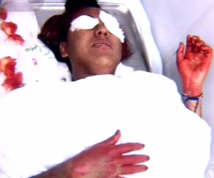 A mulher que cometeu o crime pode responder
por injúria real e lesão corporal grave

Experimente grátis: todos os programas da Record na íntegra no R7 Play
