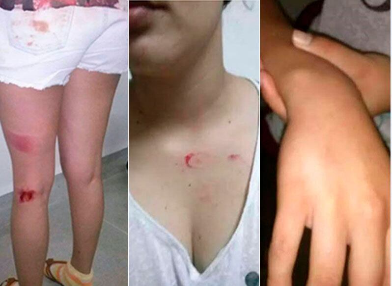 Um vereador foi acusado de ter agredido uma adolescente de 16 anos, namorada de sua filha mais velha, no município de Firmino Alves, na região Sul da Bahia. O presidente da Câmara de Vereadores da cidade, Edmilson Freitas, agrediu a jovem na noite de terça-feira (7) por não aceitar o relacionamento homoafetivo

