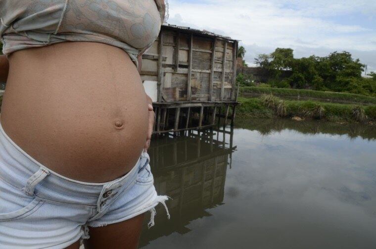 Há casos em que microcefalia só é descoberta após o parto