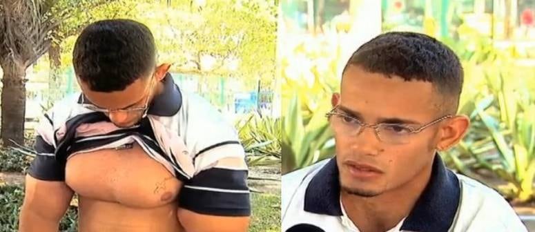 O estudante Felipe Marinho
sofre com deformações e dores no corpo após ter aplicado durante quatro anos
óleo mineral nos músculos. Ele se arrependeu de tudo que fez e chegou a pedir ajuda para conseguir
um tratamento médico. A injeção do produto aumenta os músculos, mas
apresenta sério risco à saúde. Felipe ficou com os braços, ombros e peitoral
inchados e com calombos