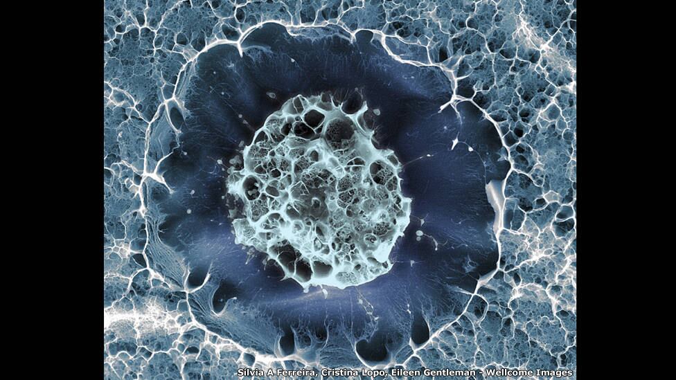 Esta imagem, que mais parece algum fenômeno marítimo, é a varredura eletrônica de uma célula-tronco retirada da medula óssea do osso do quadril de uma pessoa saudável. As autoras da foto são Silvia Ferreira, Cristina Lopo e Eileen
Gentleman, do King's College de Londres