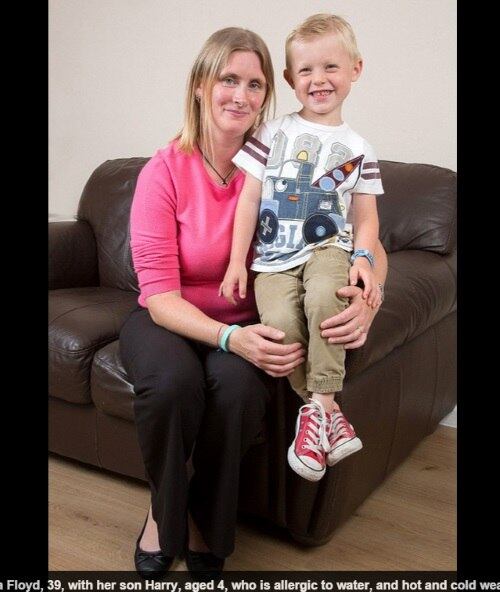 

O menino sofre com um raro tipo de urticária, no qual a água
e as temperaturas muito altas ou muito baixas causam fortes reações na pele do
menino.



— Não sabíamos o que fazer. Os médicos não descobriam o que
era e ele estava sofrendo

