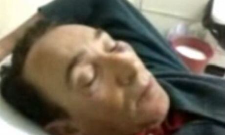 Vítima ficou com vários hematomas no rosto