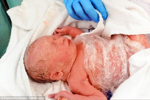 A cirurgia foi realizada pelo professor Jan Deprest, que lidera um dos quatro centros médicos na Europa que realiza esse tipo de operação