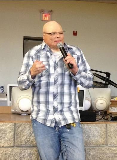 Há dez anos, Brad Hearon, 30 anos, do Colorado, Estados Unidos, era viciado em drogas. Mas um trágico acidente que queimou 80% de seu corpo transformou a sua vida. Porém, depois de passar praticamente um ano inteiro no hospital e, de lá para cá, passar por várias cirurgias, Brad deu a volta por cima