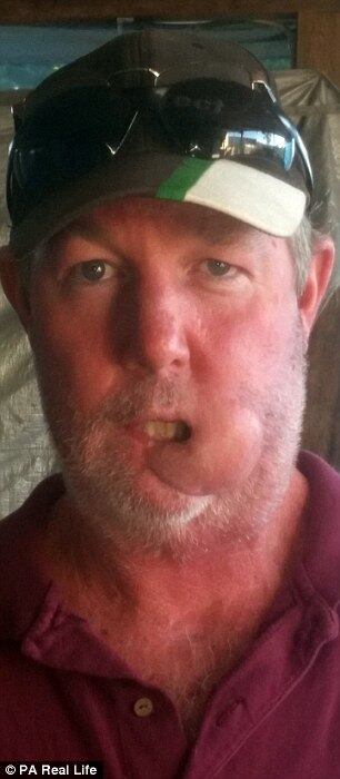 Lisle agora está em recuperação. As operações (outras se seguiram) ocorreram no Hospital Princesa Alexandra, em Bisbane, a seis horas de sua cidade. Seus filhos ficaram com os avós e a esposa, mesmo deprimida, o acompanhou
Pesquisadores ingleses descobrem que vírus do resfriado comum pode curar câncer