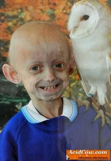 

Mesmo com a condição, Ashanti afirma que é "uma garota de sorte."



— Tenho a melhor família do mundo