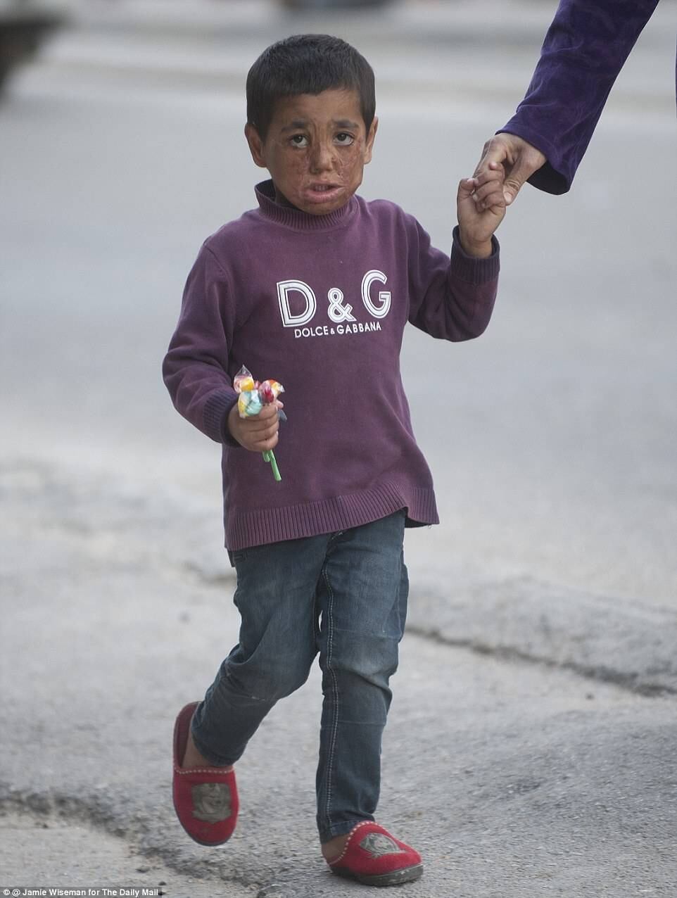 Uma guerra brutal como a que acontece na Síria faz das crianças as maiores vítimas. Os combates as atingem impiedosamente e deixam marcas para o resto da vida, como no caso do menino Mohamad

