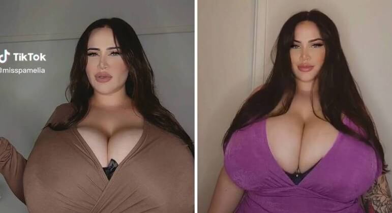 Pamelia disse que passou a sofrer com o tamanho dos seios
