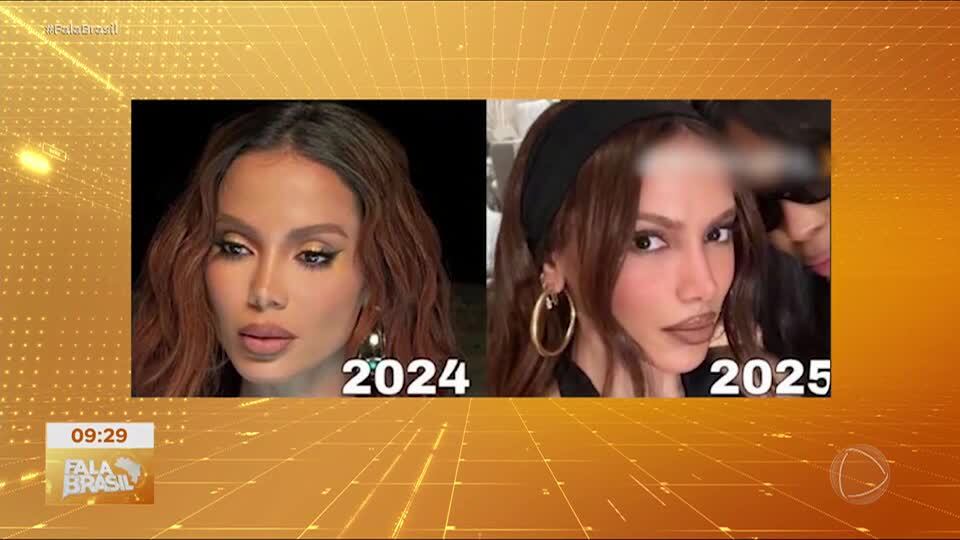 Anitta reaparece na Itália com novo visual após rumores de cirurgia