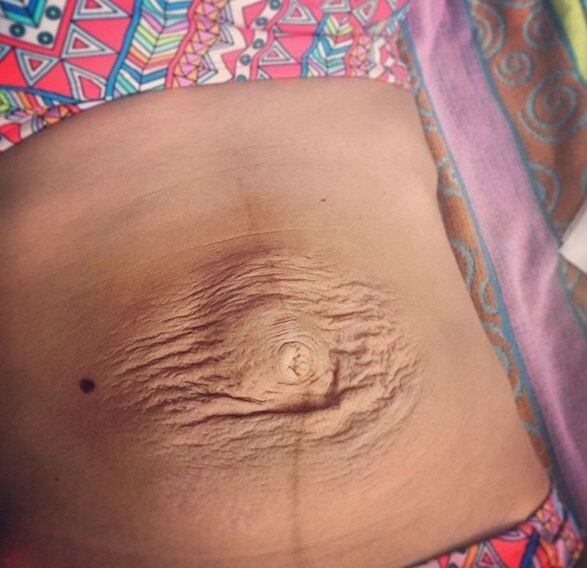 De acordo com ela, há consequências da maternidade no corpo da mulher que ela precisa aprender a conviver